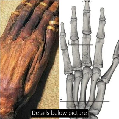 Yuya’s Mummified Hand: Testament to Ancient Egyptian Embalming Artistry.