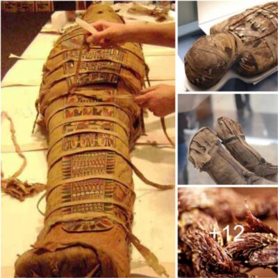 Walk Like An Egyptian… Scientists Preserve Modern Human Leg using Ancient Egyptian Methods
